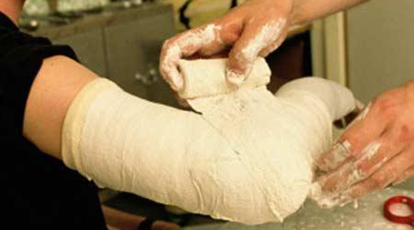 Девушке сломали правую руку. Фото с сайта: tengrinews.kz.