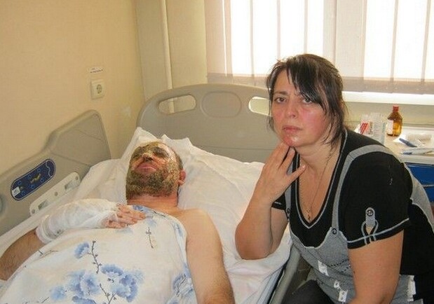 Медики обещают пострадавшему "новое лицо" и говорят, что все могло быть намного хуже. Фото - segodnya.ua.