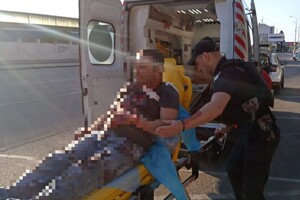 В Одессе парень прямо на улице пытался покончить с собой фото