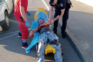 В Одессе парень прямо на улице пытался покончить с собой фото 1