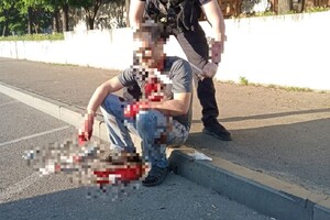 В Одессе парень прямо на улице пытался покончить с собой фото 2