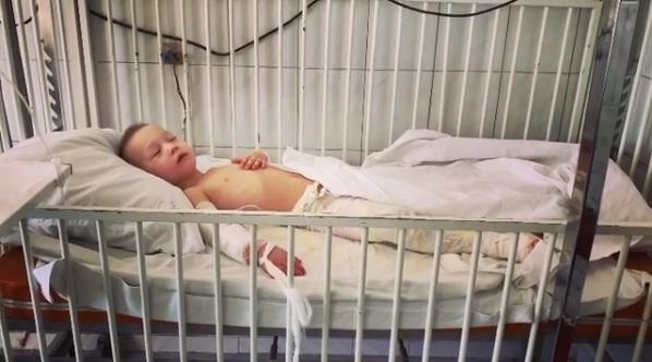 Вылил на себя кастрюлю с супом: у 5-летнего малыша сильные ожоги