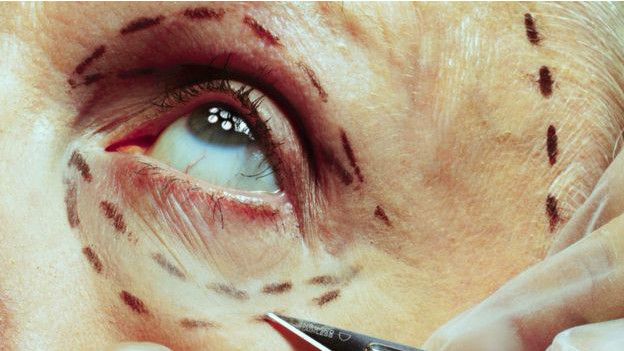 Британские власти объявили войну недобросовестным косметологам