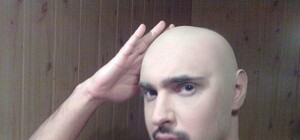 Виталий Козловский побрился налысо