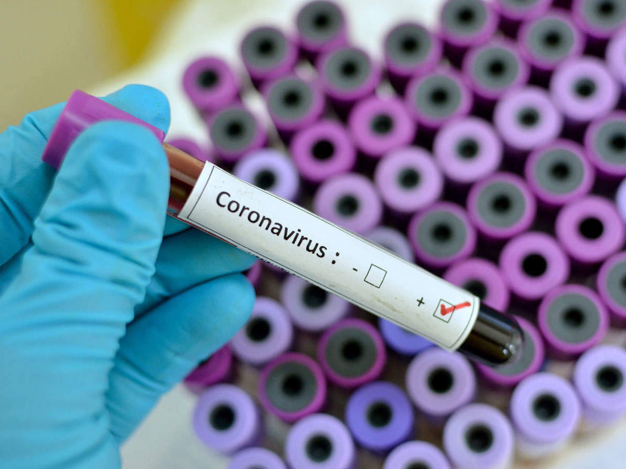 Когда в Одессе появятся тесты на коронавирус