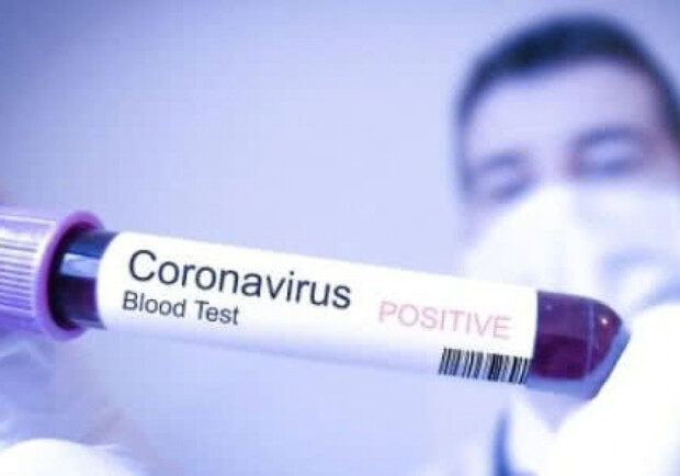 В Одессе подтвердили еще один случай заболевания коронавирусом  фото
