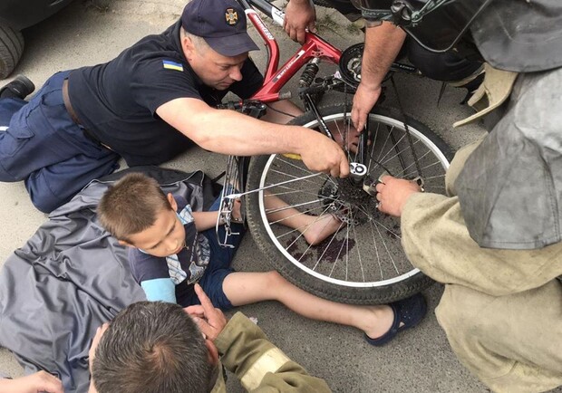  Одессе спасатели помогли мальчику освободиться от велосипеда Фото: ГСЧС