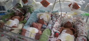 Неожиданный сюрприз: как себя чувствует тройня, рожденная в Запорожье