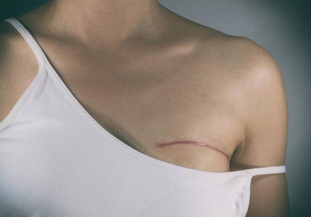 В Одессе женщины могут бесплатно пройти обследование на рак груди. Фото: ks-yanao.ru