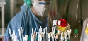 Больше анализов: в Полтавской области появится еще одна ПЦР-лаборатория