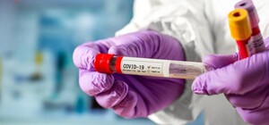 Полтава не справляется с количеством новых анализов COVID-19: часть тестов отправляют в киевскую лабораторию