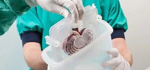 250 операций в 2021 году: в Украине заработала система по вопросам трансплантации органов