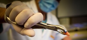 Без согласия родителей: под Киевом ребенку вырвали 12 молочных зубов за один прием