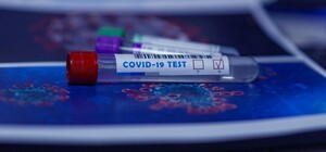 Восемь умерших: какая статистика Covid-19 в Одесской области