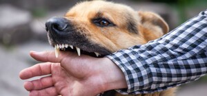 Попала в больницу: в Запорожье девушку покусал домашний пес