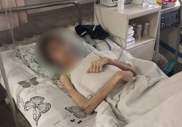 Гематомы и странное масло: отец, заморивший голодом 16-летнего одессита, рассказал о порче - фото