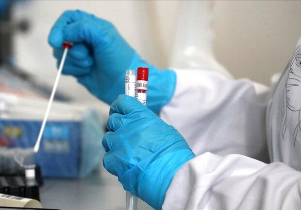 За сутки в Одесской области у 35-ти человек лабораторно подтвердили коронавирус