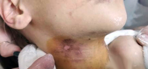 Пострадала девочка: в Харьковской области из детского дома семейного типа забрали восьмерых детей