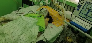 В Запорожье у девушки с ожогом 52% выявили COVID-19