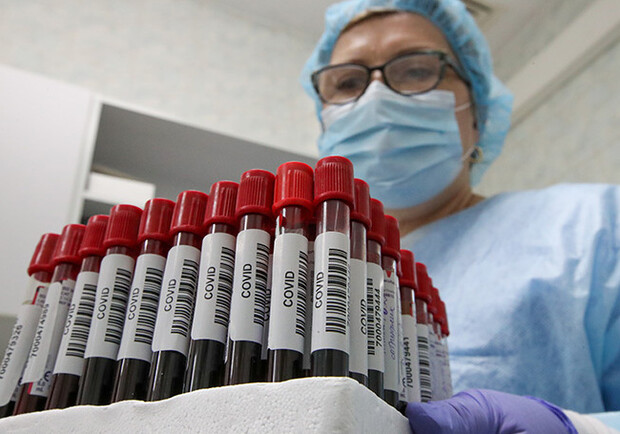 В Украине обнаружен более заразный штамм коронавируса "Дельта плюс". 