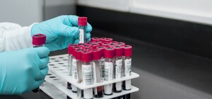 В Днепре открыли еще одну ПЦР-лабораторию