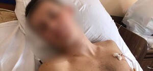 Под Киевом парень заступился за мать и получил удар ножом от соседки