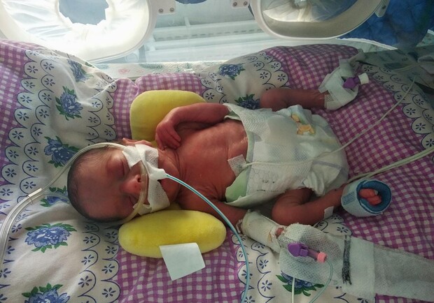 В Одесі медики врятували двох немовлят, які важили менше ніж 900 грам. 