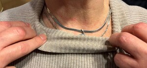 В Дарницком районе женщину в хостеле ограбили и душили до потери сознания 