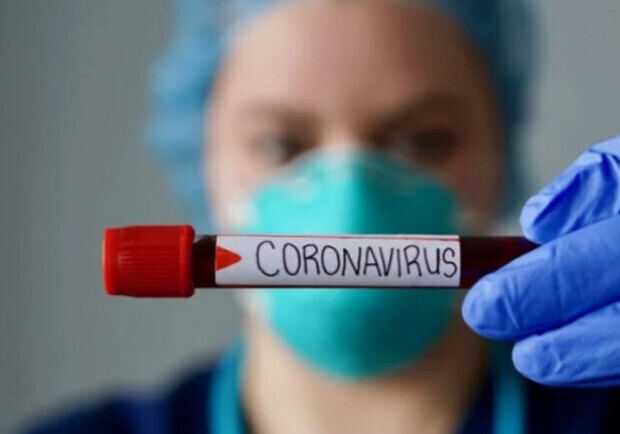 Цифра дня: cколько людей за год скончались от коронавируса в Одесской области. 