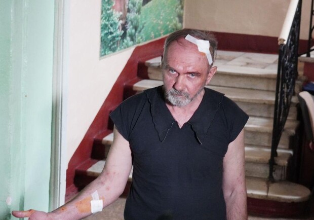 Как чувствует себя пострадавший во время обстрела монастыря в Одессе. 