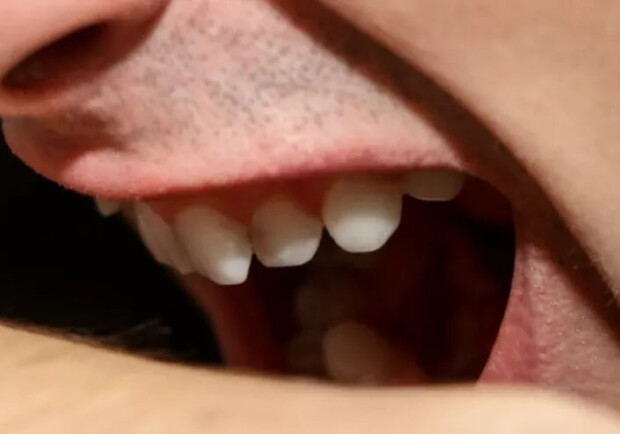 В Одессе мужчина покусал женщину в ресторане - фото