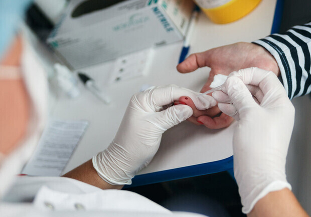 Одесити можуть безкоштовно пройти тест на ВІЛ та гепатити. 