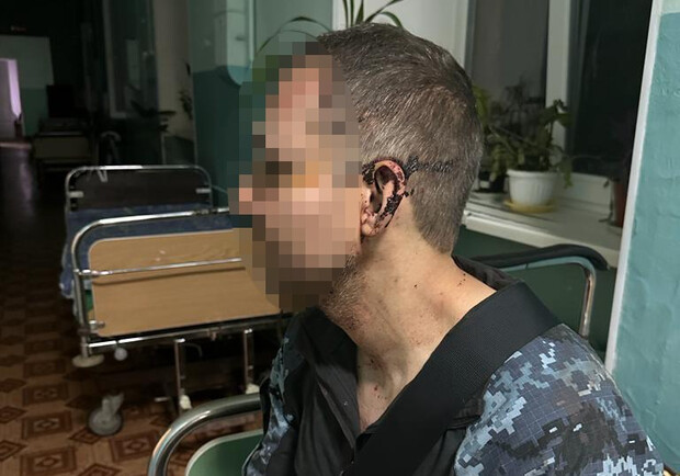 ДБР взялася за розслідування побиття солдата в одній із військових частин на Одещині. 