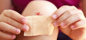 На Одещині зареєстрували підозру на правець: симптоми