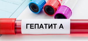 В Киевской области зафиксирован случай гепатита А