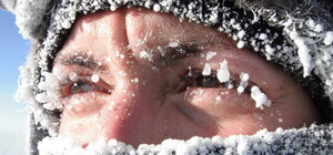 На Львівщині госпіталізували 11 людей з холодовими травмами