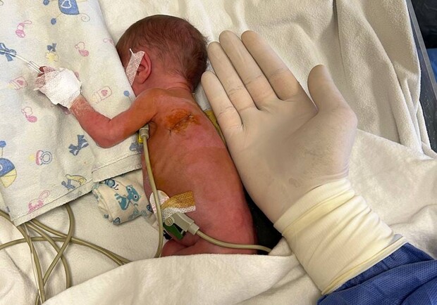 В Одессе прооперировали младенца с врожденным пороком сердца. 