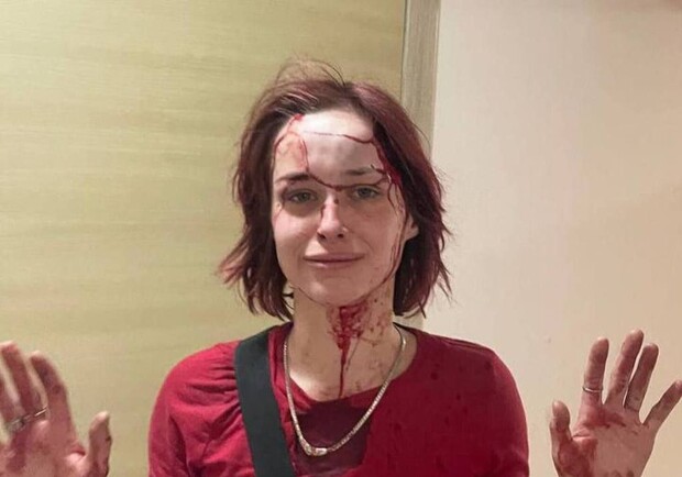 У поліції прокоментували побиття дівчини в Одесі. 
