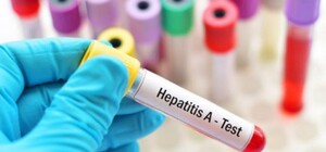 У Києві - спалах «хвороби Боткіна»: симптоми і способи захисту інфекції