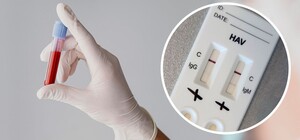 Спалах гепатиту А у Києві: стала відома причина  хвороби