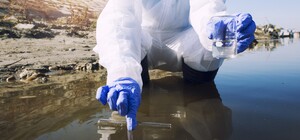 У Дніпропетровській області виявили холерний вібріон у воді