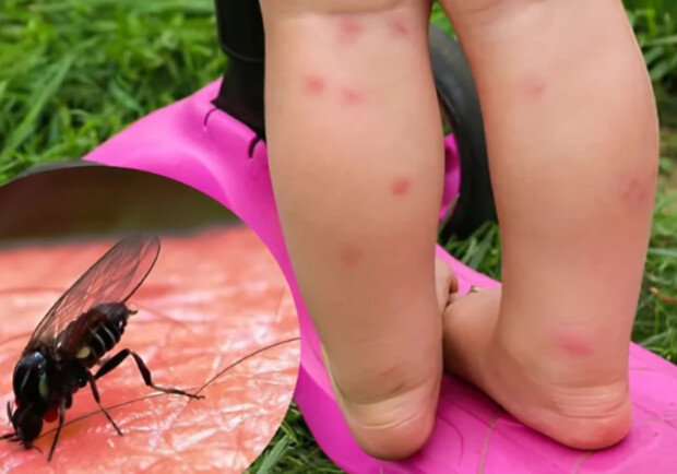 У Дніпропетровській області активізувалися мокреці: укуси можуть спричинити алергію