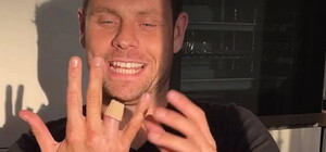 Зацепился обручальным кольцом: украинский актер потерял палец в развлекательном центре Киева