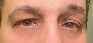 Напад на військового в Одесі: коментар ТЦК