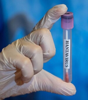 Чи загрожує хантавірус Україні: що відомо про небезпечну інфекцію