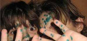 В Крыму началась эпидемия ветрянки?