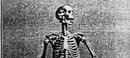 Миниатюрный скелет создан одесским именитым ювелиром. Фото: odessa-history.livejournal.com.
