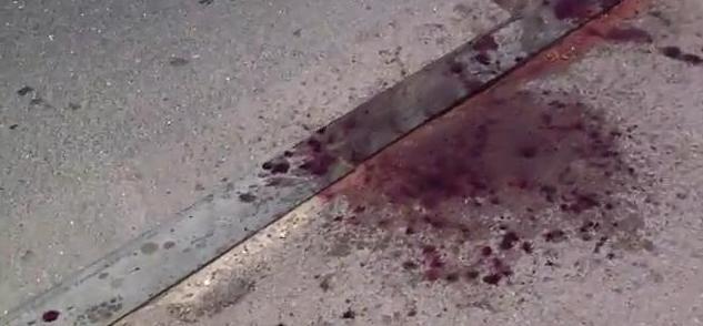 Кровью мопедиста была залита дорога. Фото: PrtSc с видео Виктора Сухенко.