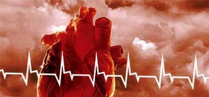 Военному офицеру нужна срочная пересадка сердца