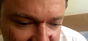 В Одессе избили кандидата в народные депутаты